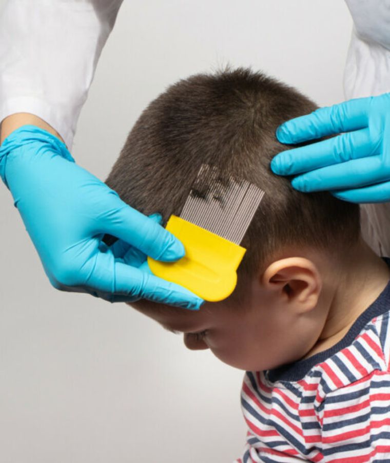 boy having his head combed with a lice comb by an adult wearing blue gloves